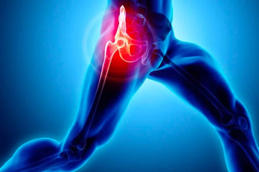 fracture col du femur institut chirurgie de paris chirurgien orthopediste specialiste chirurgie orthopedique paris